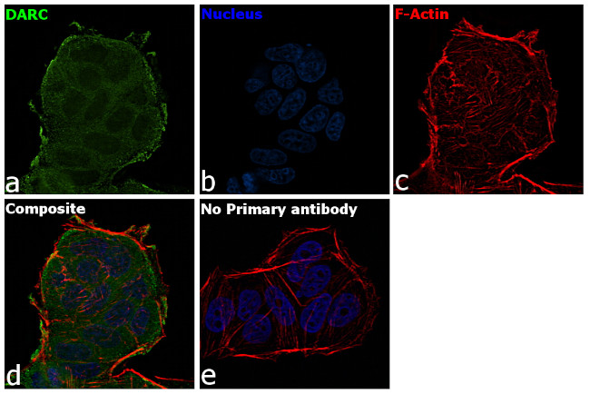 DARC Antibody in Immunocytochemistry (ICC/IF)