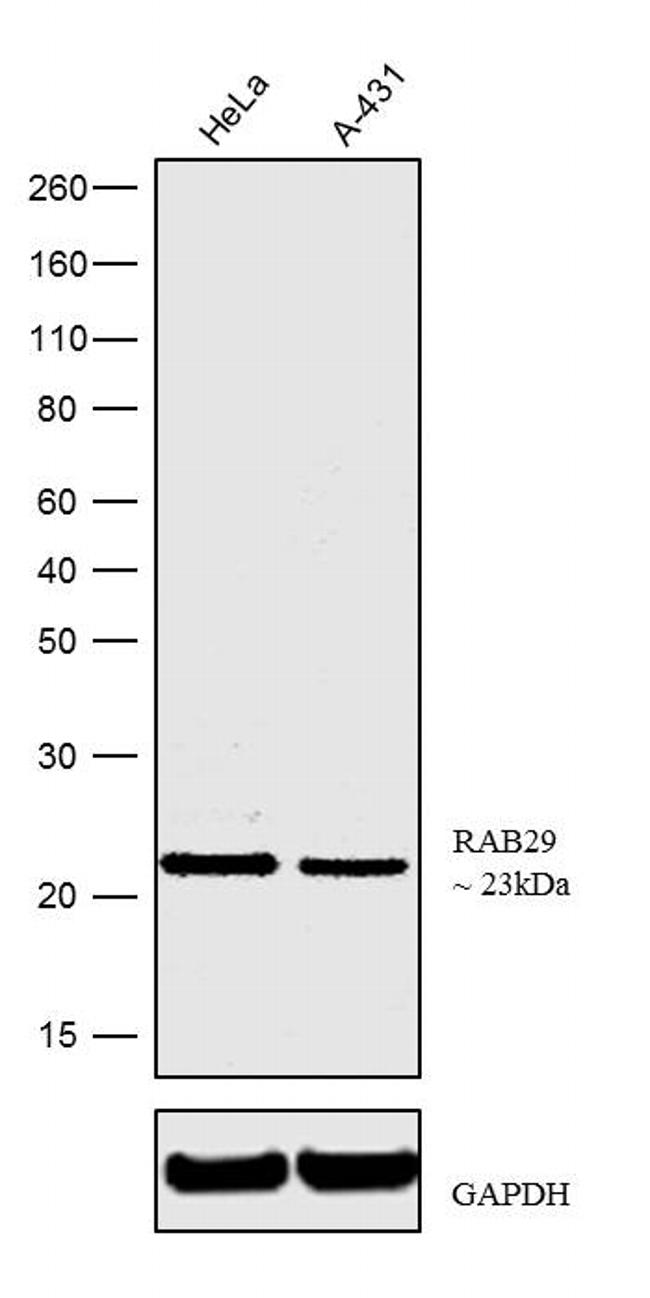 RAB29 Antibody in Western Blot (WB)