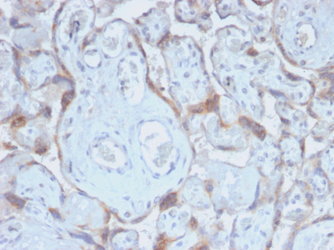 TIMP2 (Tissue Inhibitor of Metalloproteinase 2) Antibody in Immunohistochemistry (Paraffin) (IHC (P))