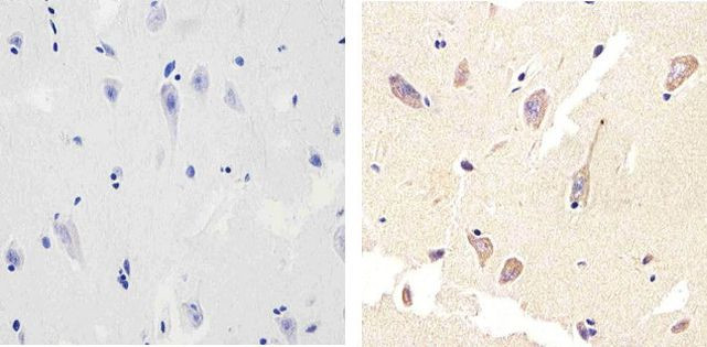 LC3B Antibody in Immunohistochemistry (Paraffin) (IHC (P))