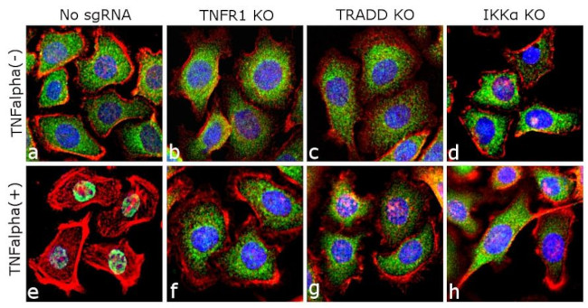 NFkB p65 Antibody