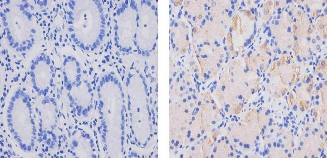 MCP-2 Antibody in Immunohistochemistry (Paraffin) (IHC (P))