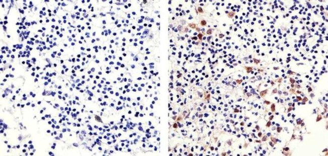 Phospho-Rb (Ser780) Antibody in Immunohistochemistry (Paraffin) (IHC (P))