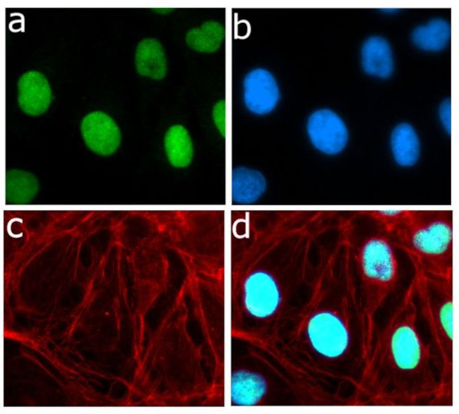 Phospho-Rb (Ser780) Antibody in Immunocytochemistry (ICC/IF)