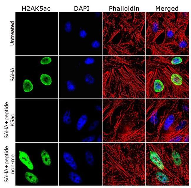 H2AK5ac Antibody