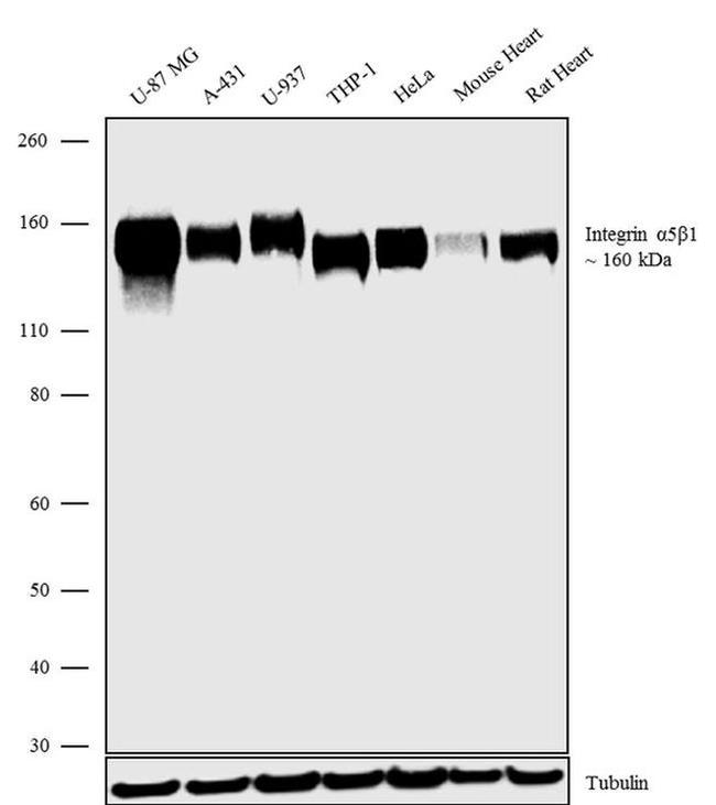 ITGA5 Antibody in Western Blot (WB)