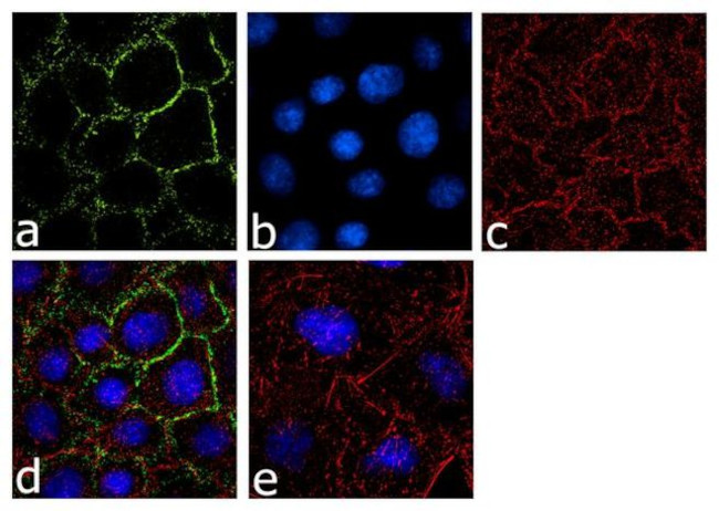 ILK Antibody in Immunocytochemistry (ICC/IF)