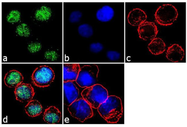 IRF4 Antibody in Immunocytochemistry (ICC/IF)