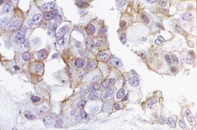 Occludin Antibody in Immunohistochemistry (IHC)