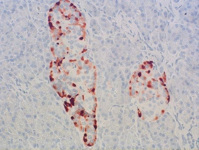 GPR68 Antibody in Immunohistochemistry (IHC)