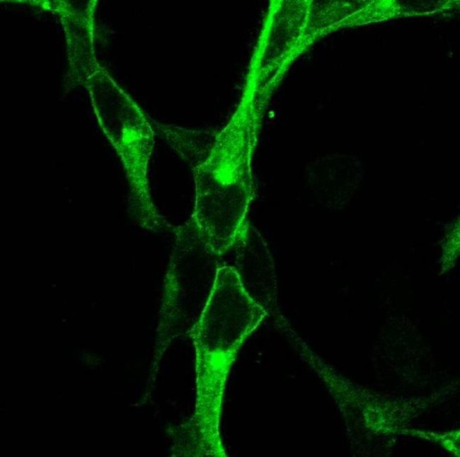 mGluR4 Antibody in Immunocytochemistry (ICC/IF)