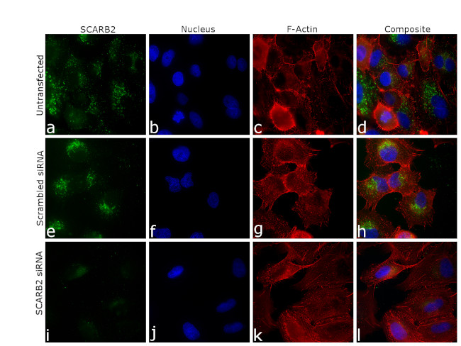 LIMP2 Antibody