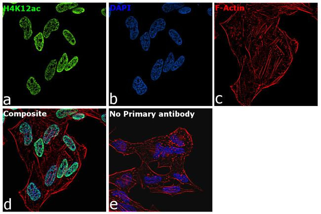 H4K12ac Antibody in Immunocytochemistry (ICC/IF)