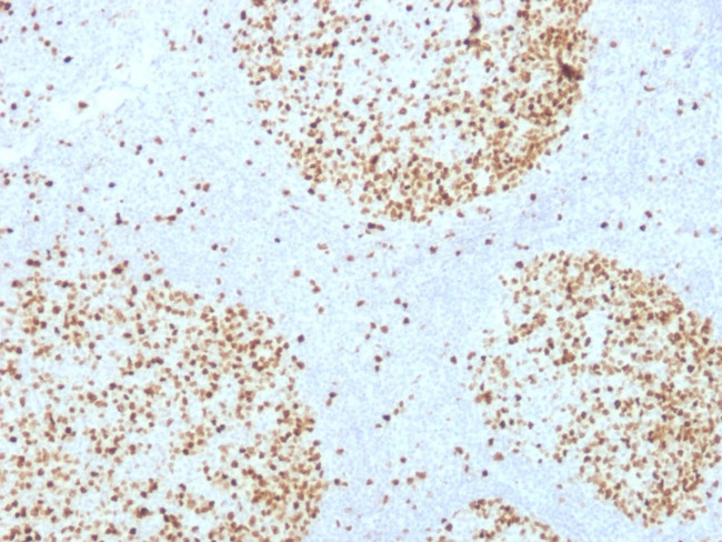 Topoisomerase II alpha (Proliferation and Drug-Resistance Marker) Antibody in Immunohistochemistry (Paraffin) (IHC (P))