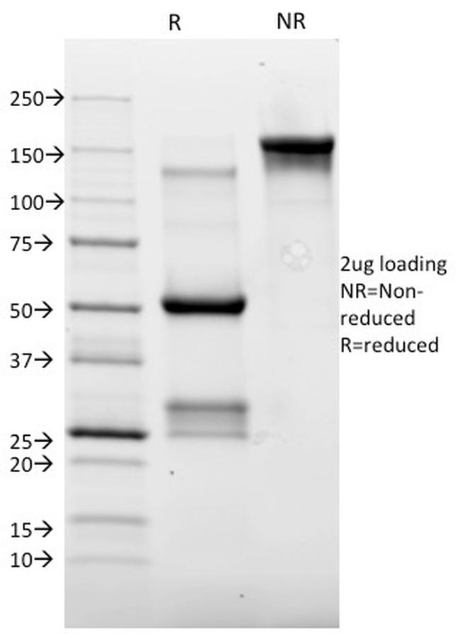 Topoisomerase II alpha Antibody in SDS-PAGE (SDS-PAGE)