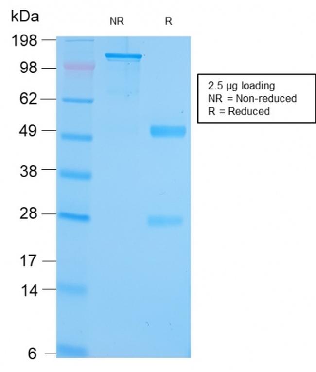 GRP94/HSP90B1 Antibody in SDS-PAGE (SDS-PAGE)
