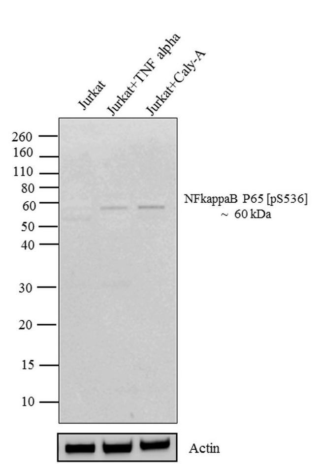 Phospho-NFkB p65 (Ser536) Antibody in Western Blot (WB)