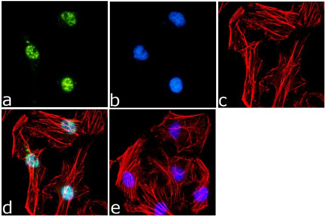 Phospho-Histone H3 (Ser28) Antibody in Immunocytochemistry (ICC/IF)