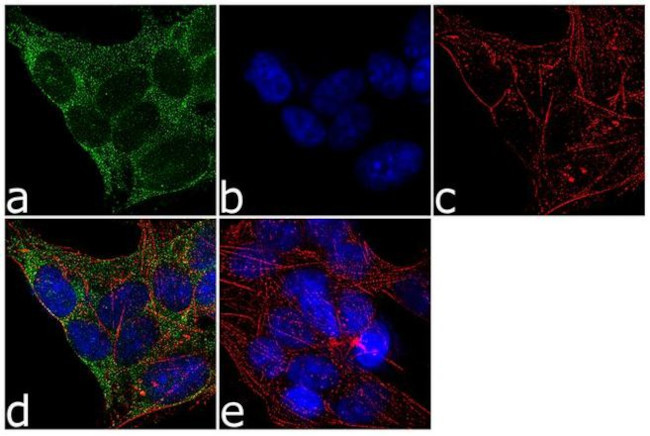 SMN1 Antibody in Immunocytochemistry (ICC/IF)