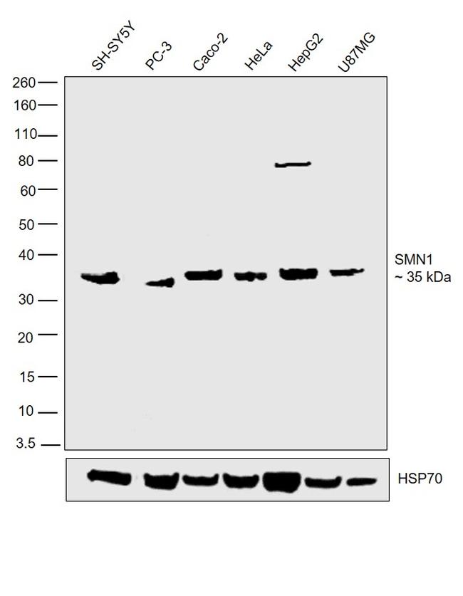 SMN1 Antibody in Western Blot (WB)