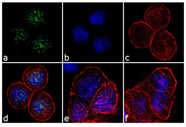 BUBR1 Antibody in Immunocytochemistry (ICC/IF)