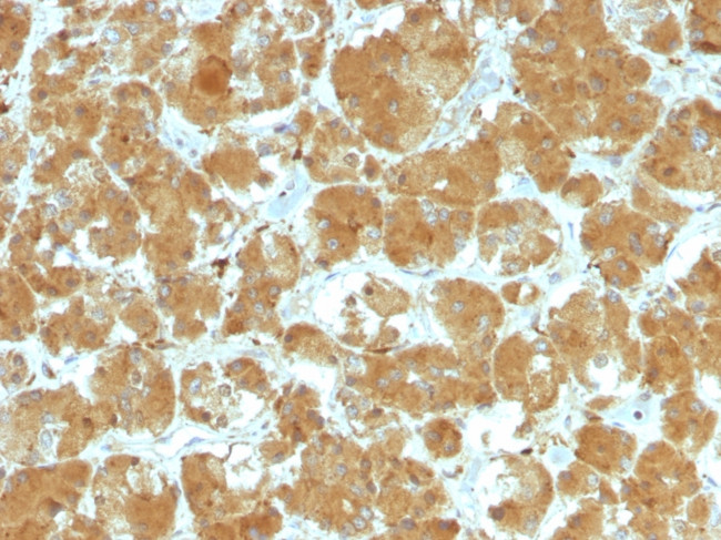 TSH-Receptor, A-Chain (Thyroid Marker) Antibody in Immunohistochemistry (Paraffin) (IHC (P))