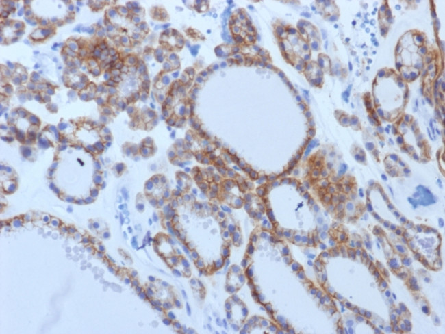 TSH-Receptor, B-Chain Antibody in Immunohistochemistry (Paraffin) (IHC (P))