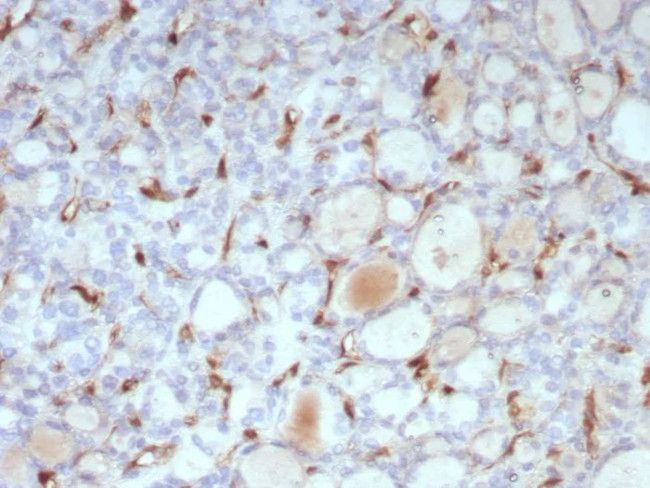 TSH-Receptor, B-Chain (Thyroid Marker) Antibody in Immunohistochemistry (Paraffin) (IHC (P))