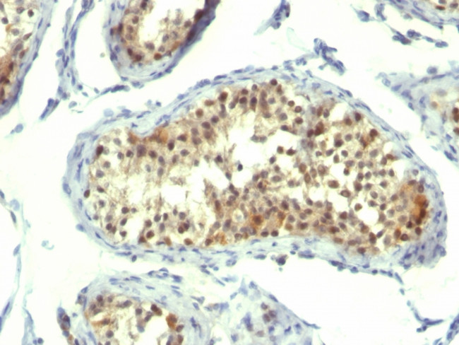 Thymidylate Synthase (5-FU Resistance Marker) Antibody in Immunohistochemistry (Paraffin) (IHC (P))