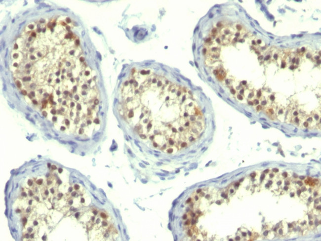 Thymidylate Synthase (5-FU Resistance Marker) Antibody in Immunohistochemistry (Paraffin) (IHC (P))