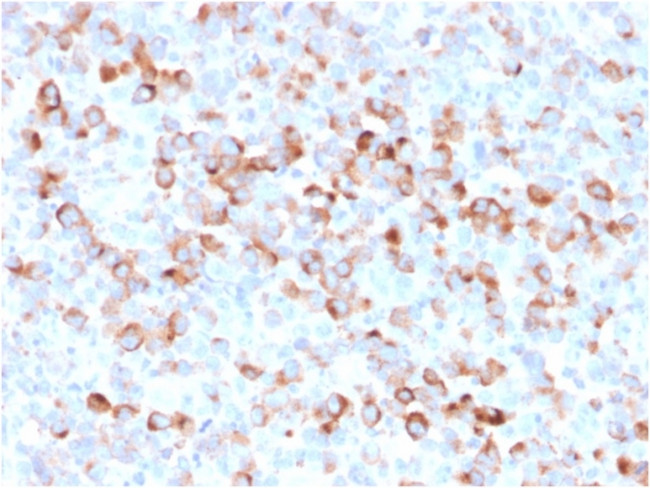 Tyrosinase Antibody in Immunohistochemistry (Paraffin) (IHC (P))