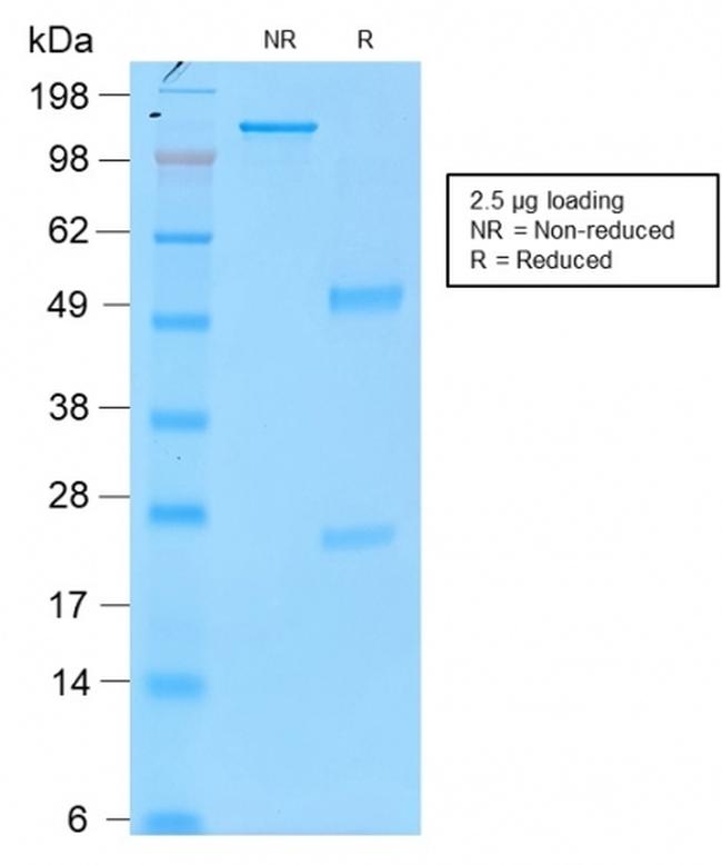 Tyrosinase Antibody in SDS-PAGE (SDS-PAGE)