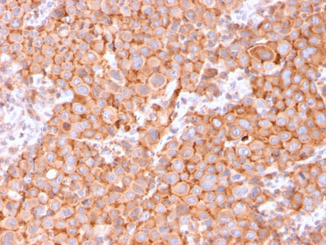 Uroplakin 1B Antibody in Immunohistochemistry (Paraffin) (IHC (P))