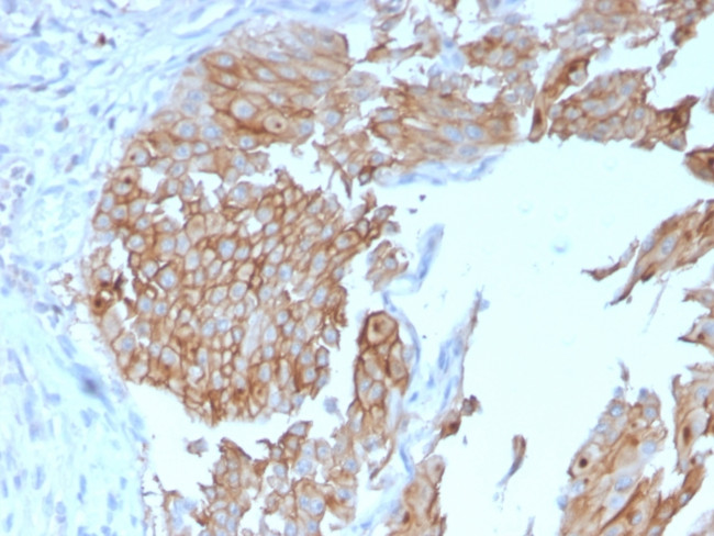 Uroplakin 1B Antibody in Immunohistochemistry (Paraffin) (IHC (P))