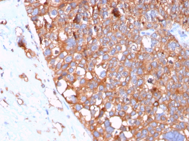 Uroplakin 1B Antibody in Immunohistochemistry (Paraffin) (IHC (P))