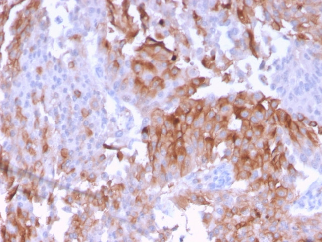 Uroplakin 1B Antibody in Immunohistochemistry (Paraffin) (IHC (P))