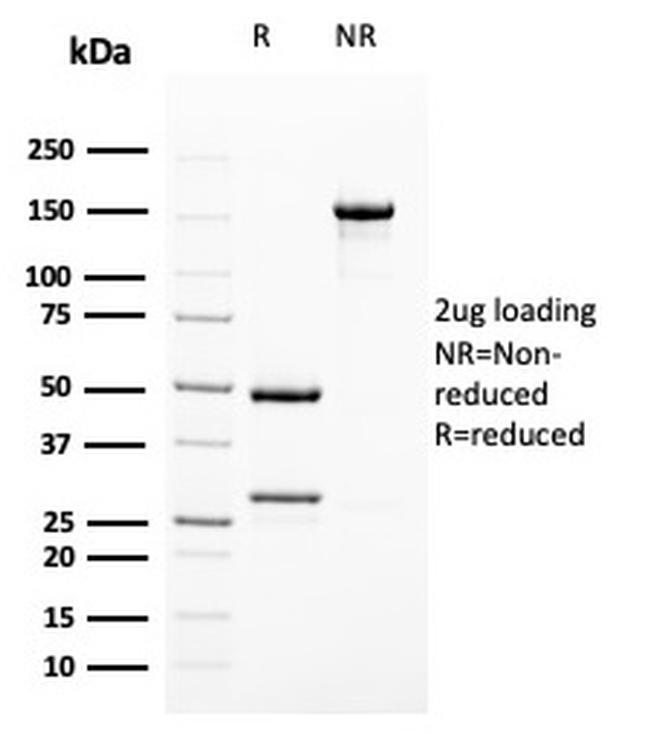 Uroplakin 1B Antibody in SDS-PAGE (SDS-PAGE)