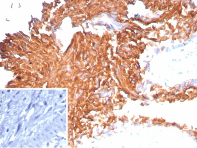 Uroplakin 1B (Urothelial Differentiation Marker) Antibody in Immunohistochemistry (Paraffin) (IHC (P))