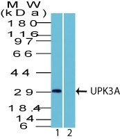 Uroplakin 3A (Bladder Carcinoma Marker) Antibody in Western Blot (WB)