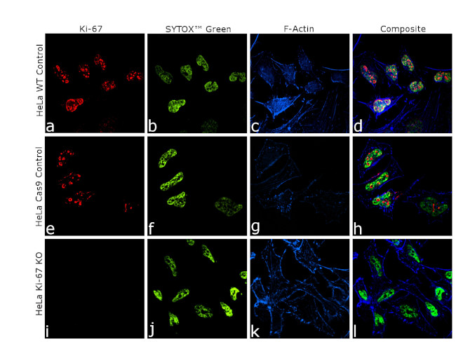 Ki-67 Antibody