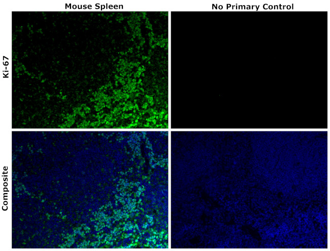 Ki-67 Antibody in Immunohistochemistry (Paraffin) (IHC (P))