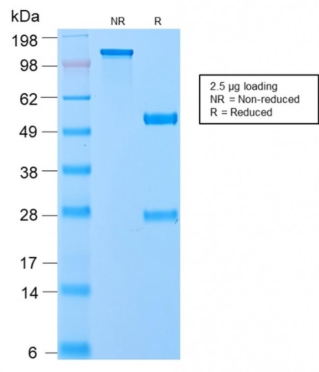 VLDL-Receptor (Very Low Density Lipoprotein Receptor) Antibody in SDS-PAGE (SDS-PAGE)