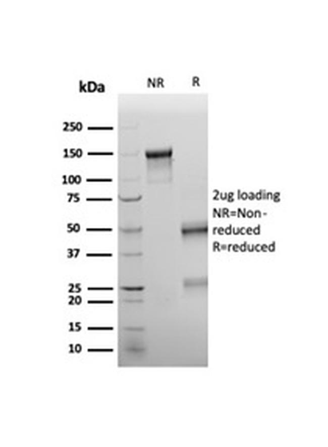 Wilms Tumor 1 (WT1) Antibody in SDS-PAGE (SDS-PAGE)