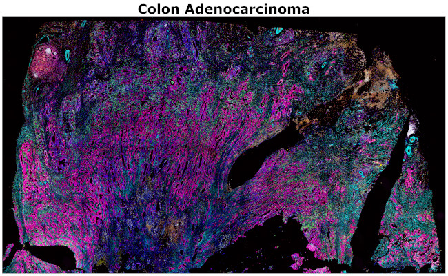 CD8 alpha Antibody in Immunohistochemistry (Paraffin) (IHC (P))