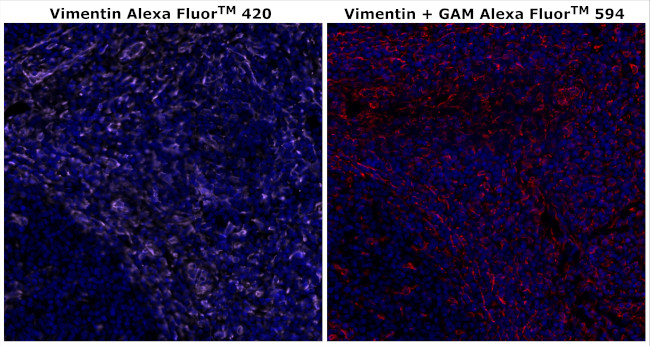 Vimentin Antibody in Immunohistochemistry (Paraffin) (IHC (P))