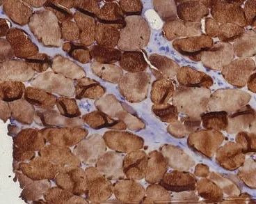 Carbonic Anhydrase 3/CA3 Antibody in Immunohistochemistry (Paraffin) (IHC (P))