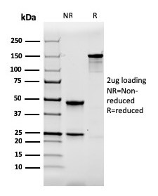 Calbindin 1 (CALB1) Antibody in SDS-PAGE (SDS-PAGE)