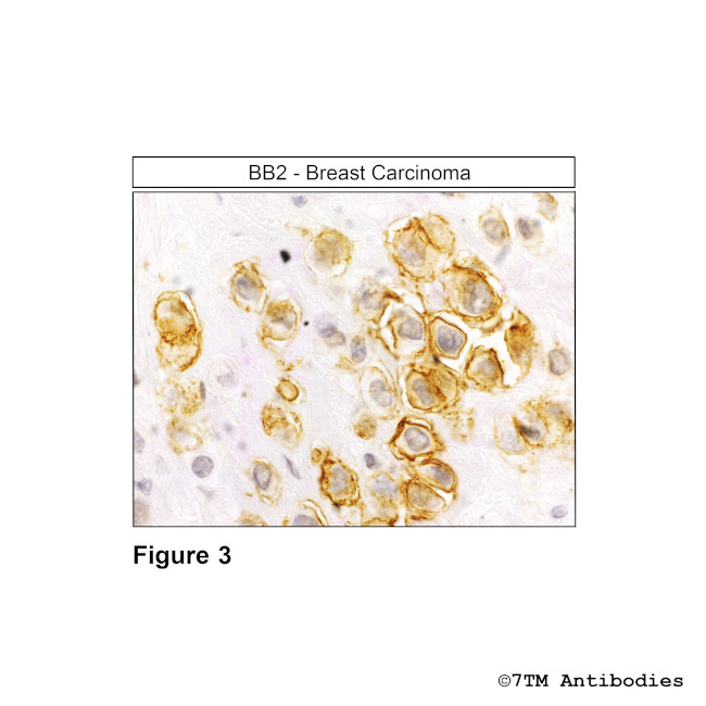 BB2, Bombesin Receptor 2 Antibody in Immunohistochemistry (Paraffin) (IHC (P))