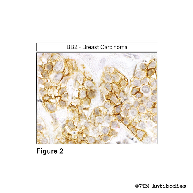 BB2, Bombesin Receptor 2/Gastrin-Releasing Peptide Receptor Antibody in Immunohistochemistry (Paraffin) (IHC (P))