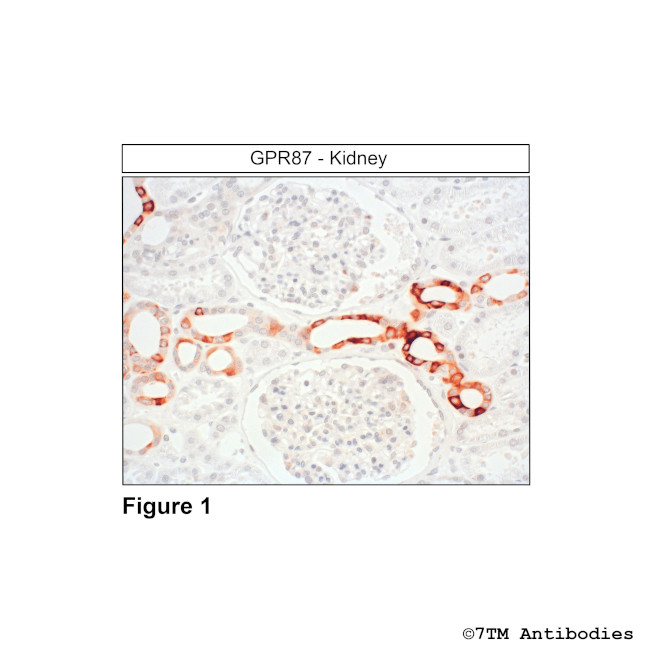 GPR87, G Protein-Coupled Receptor 87 Antibody in Immunohistochemistry (Paraffin) (IHC (P))